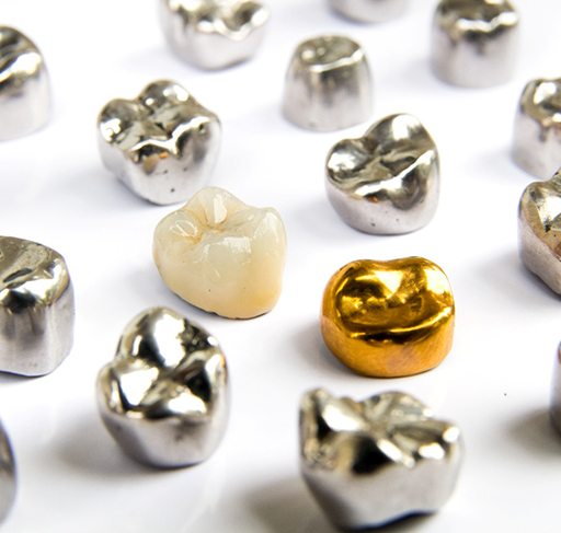 Various metal and tooth-colored dental crowns on a white surface
