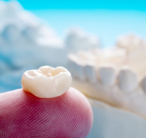 Dental crown resting on a finger