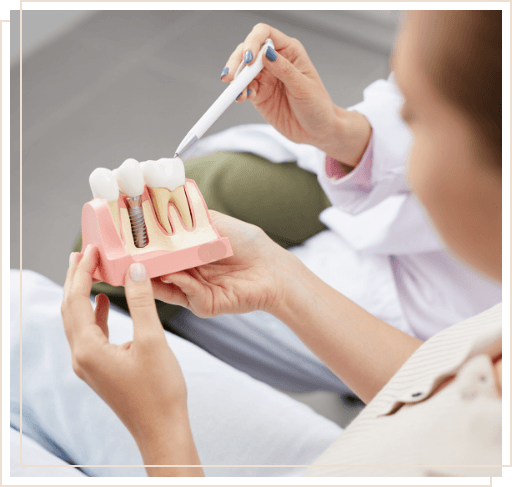 Dentist showing a patient a model of dental implant