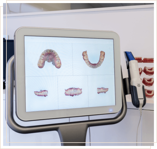 Several digital models of a row of teeth on computer monitor