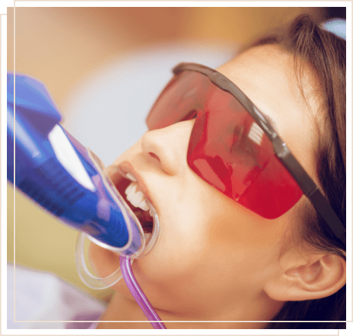 Young woman with fluoride treatment trays over her teeth in dental office